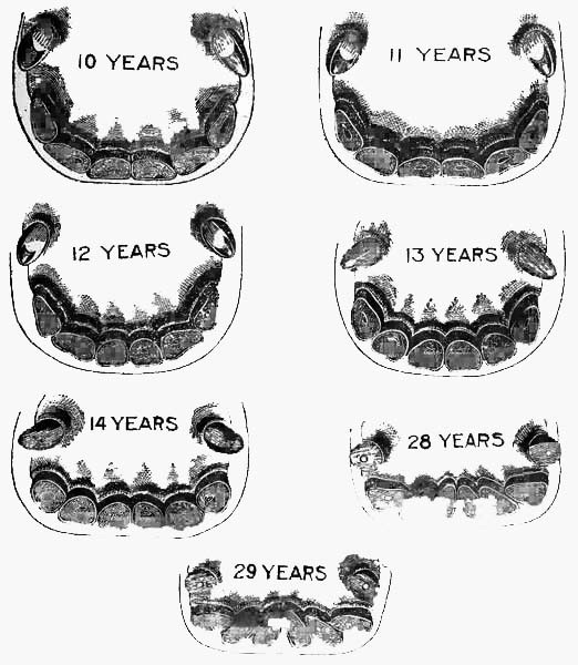 More horses' teeth