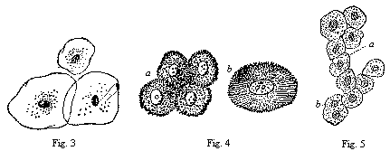 Fig. 3--Three epithelial cells. Fig. 4--Five spiny or grooved cells. Fig. 5--Ten liver-cells.